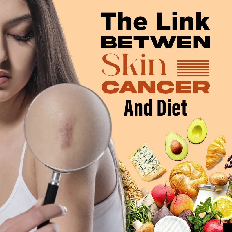 glutathione and skin cancer The Link Between Diet restricted-eu Are B12 injections available Size:10 Tablets