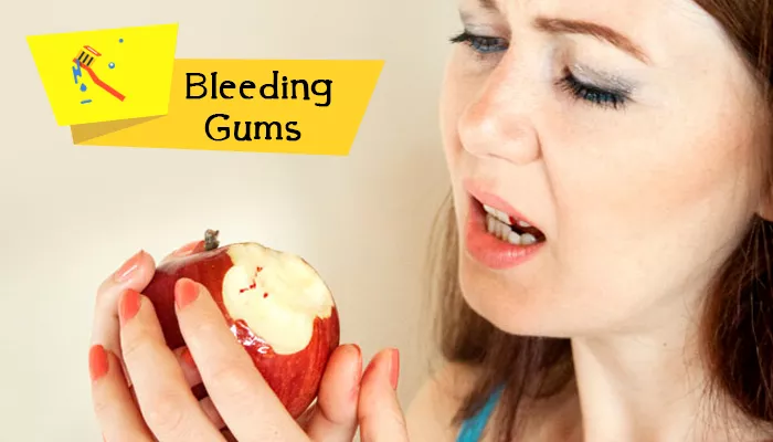 What Causes Bleeding Gums and How to Treat It