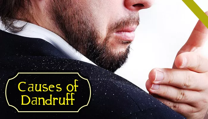 What Causes Dandruff And How To Get Rid Of It