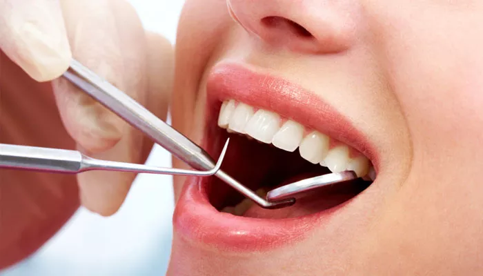 All You Need To Know About Tooth Decay