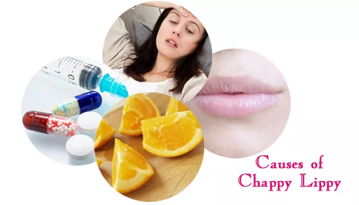 Causes of Chappy Lippy