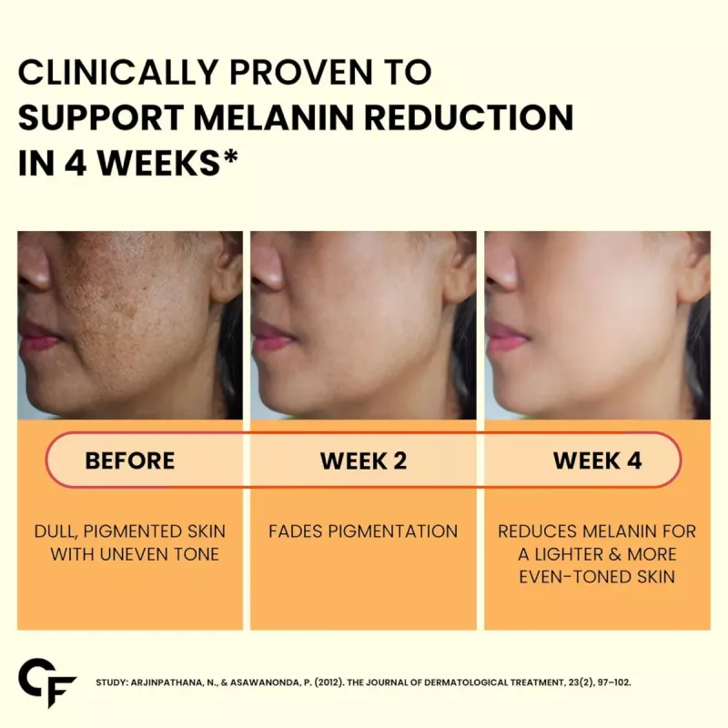 carbamide forte glutathione Gluta Drip – Savouge Aesthetics main image 0